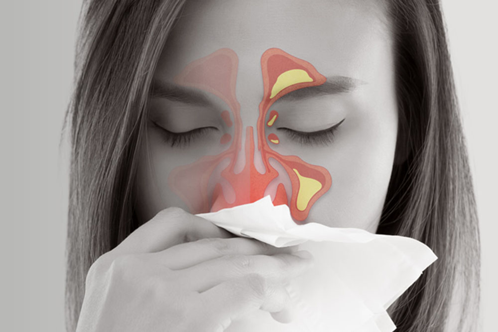 A woman with closed eyes holds a tissue to her nose; an illustration of inflamed sinuses is overlaid on her face, indicating sinus congestion or infection.