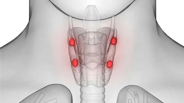Parathyroidectomy